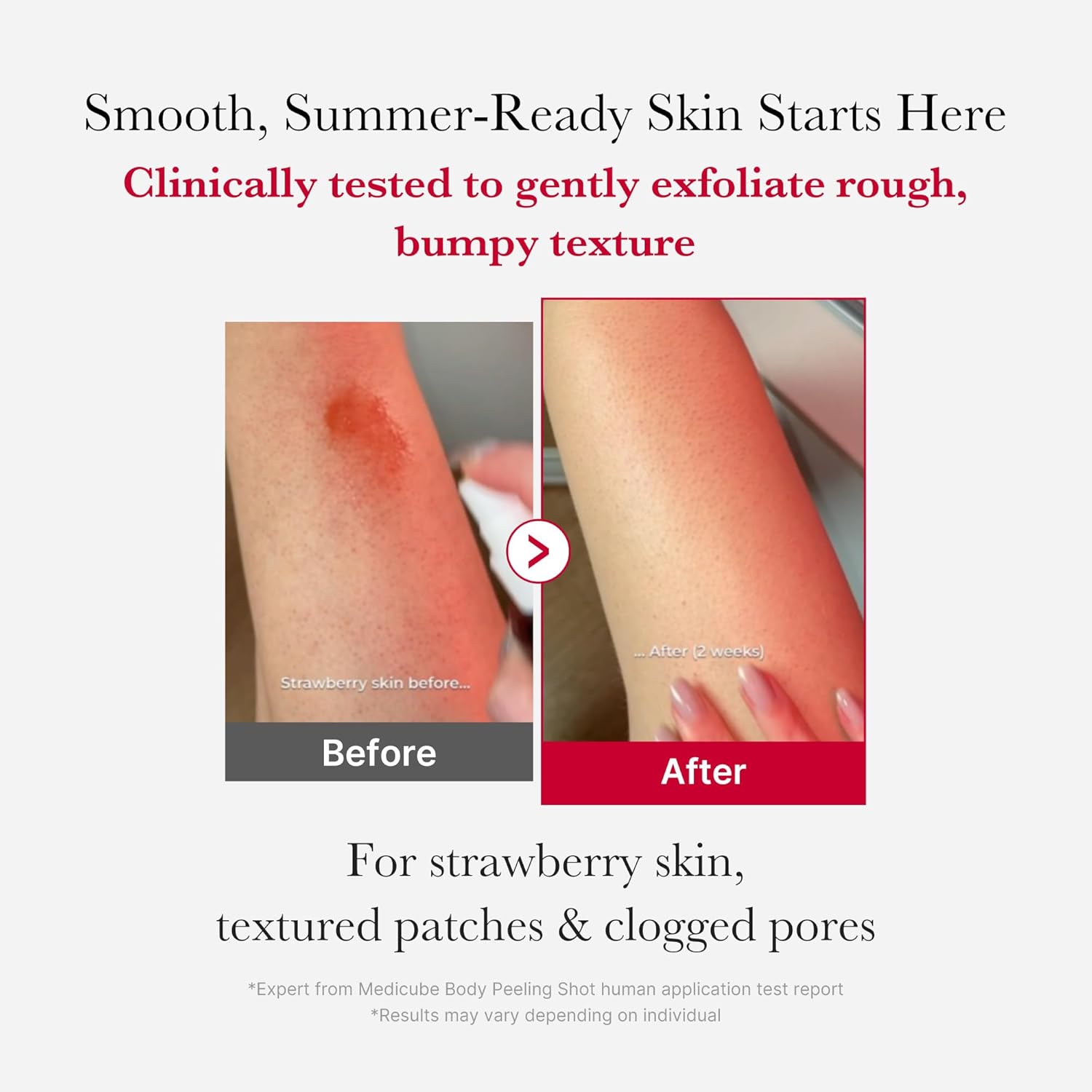 Medicube Red Acne Body Peeling Shot