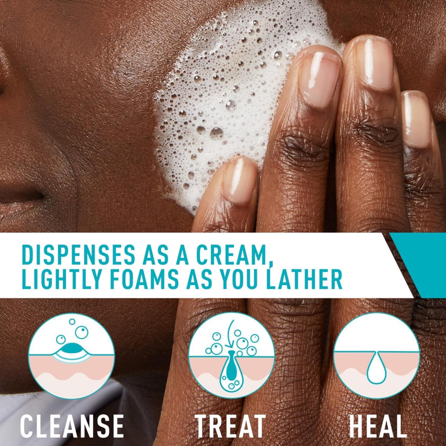 Cerave Acne Foaming Cream Cleanser 4%