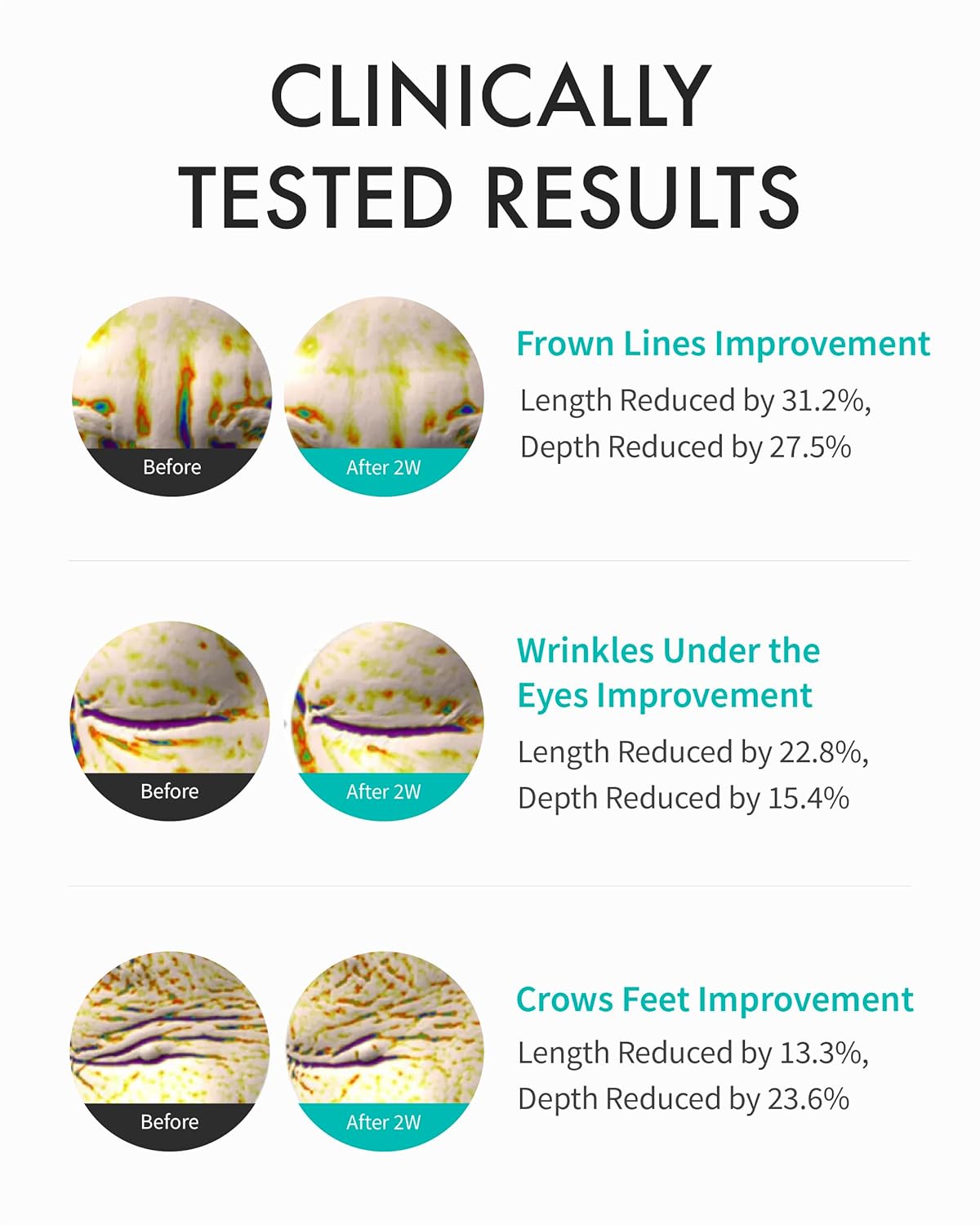 REJURAN Intensive Eye Cream