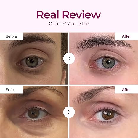 Dr. Melaxin Cemenrete Calcium Volume Cream