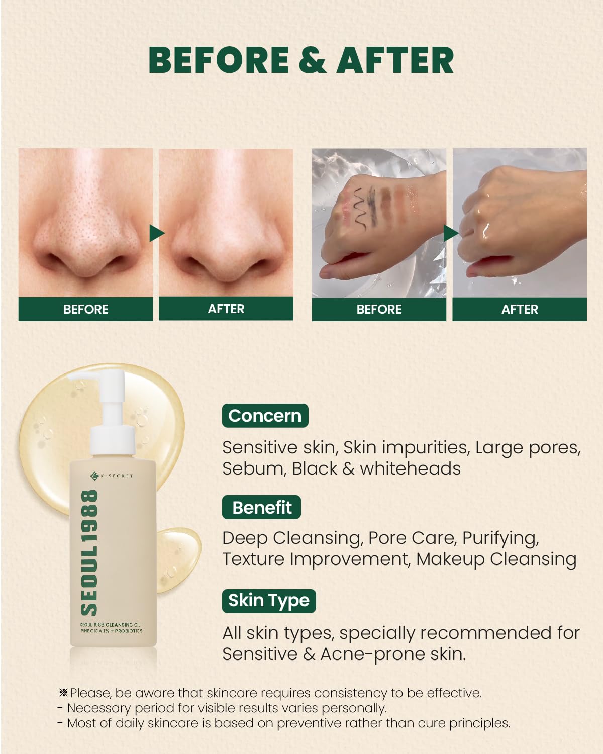 Ksecret SEOUL 1988 Cleansing Oil Pine Cica 1% + Probiotics