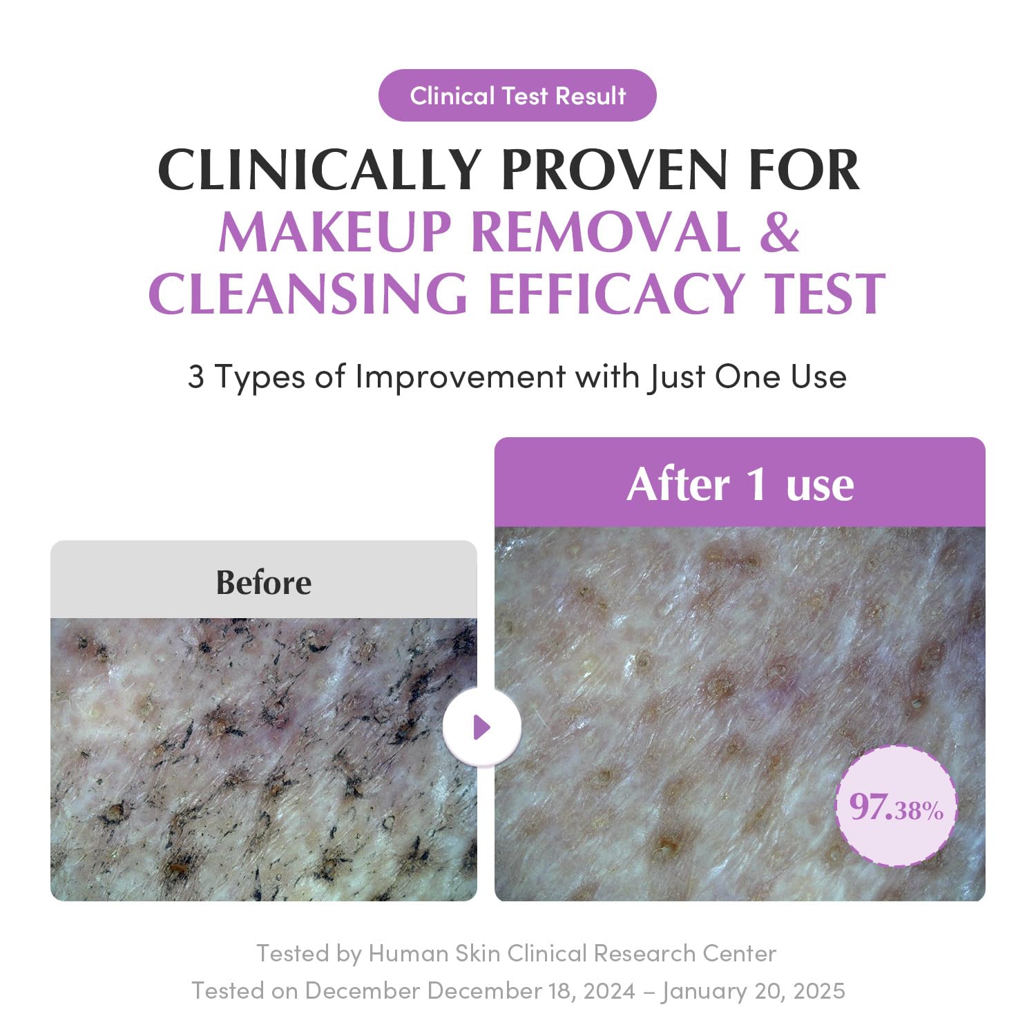 Eqqualberry Purple Rice  Pore Smoothing Cleansing Oil