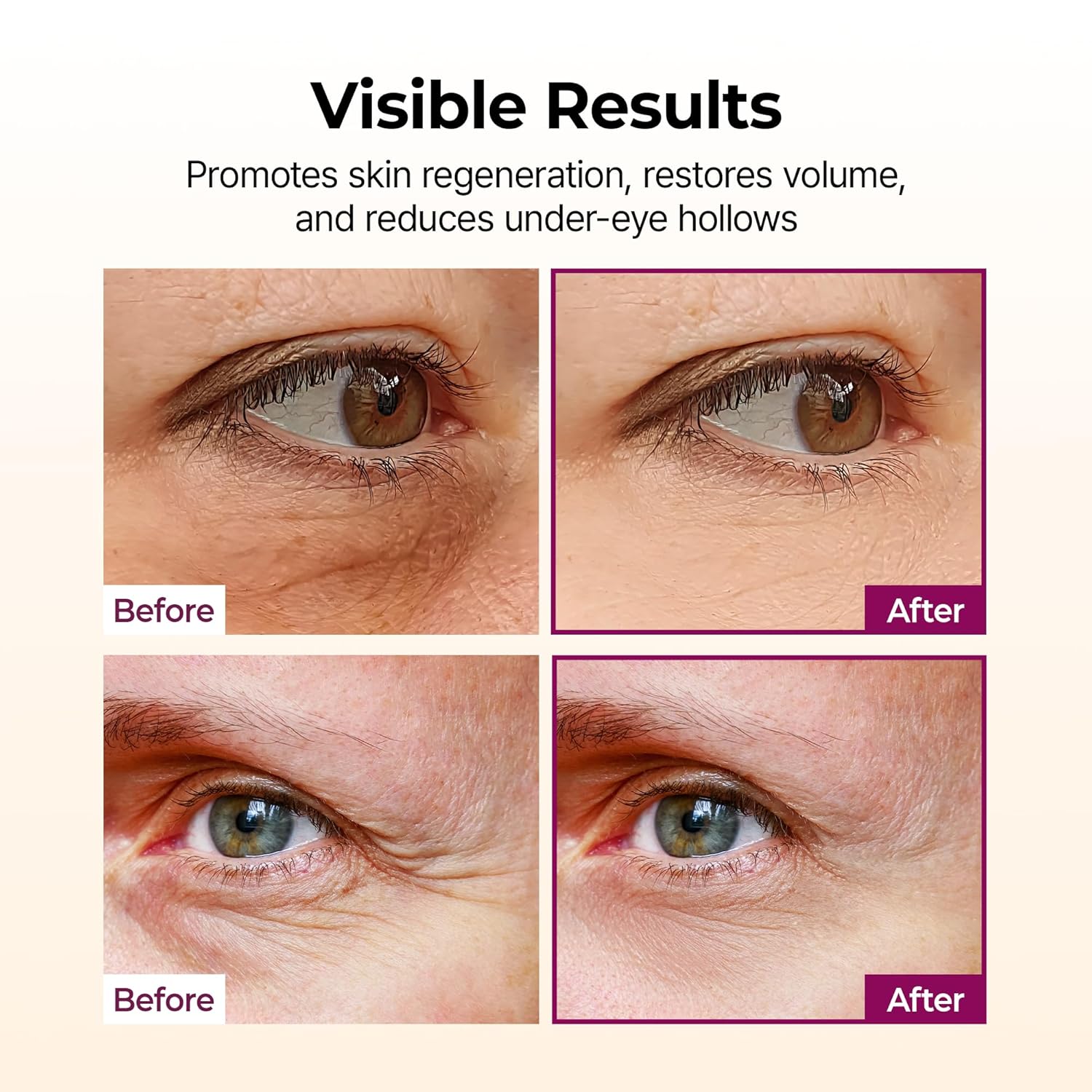 Dr. Melaxin Cemenrete Calcium Volume Multi Balm