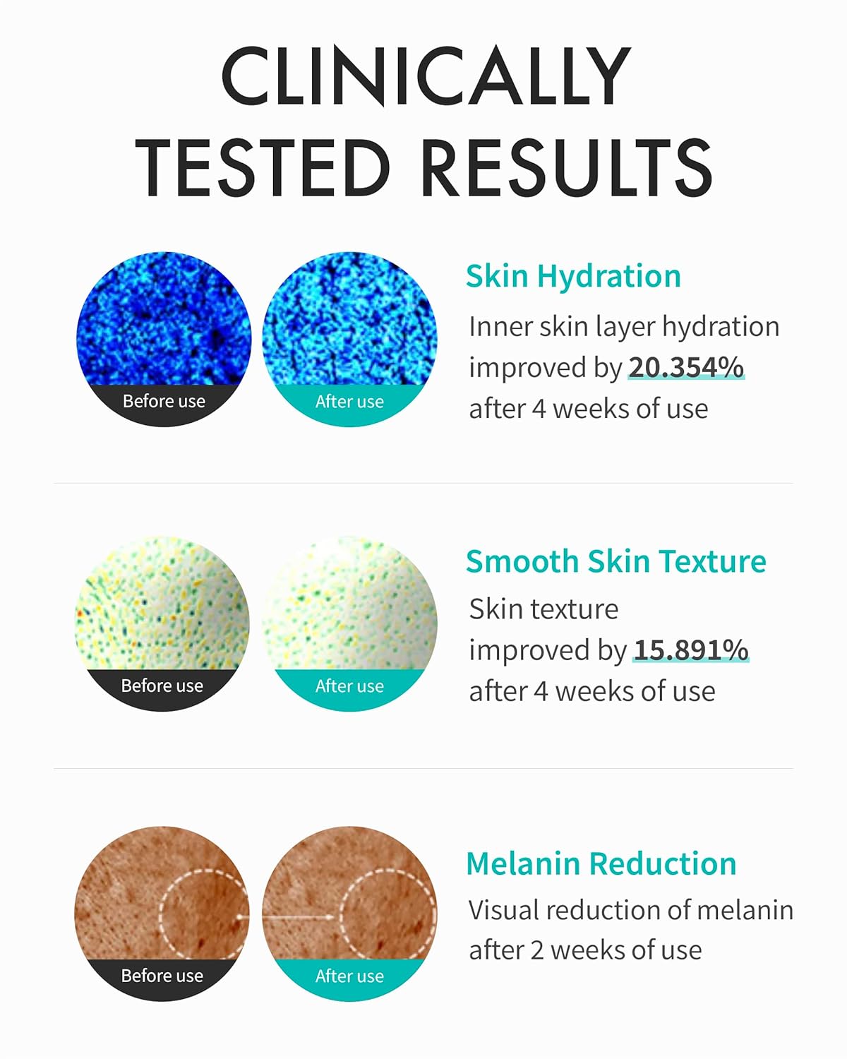 REJURAN Cream Enchanced