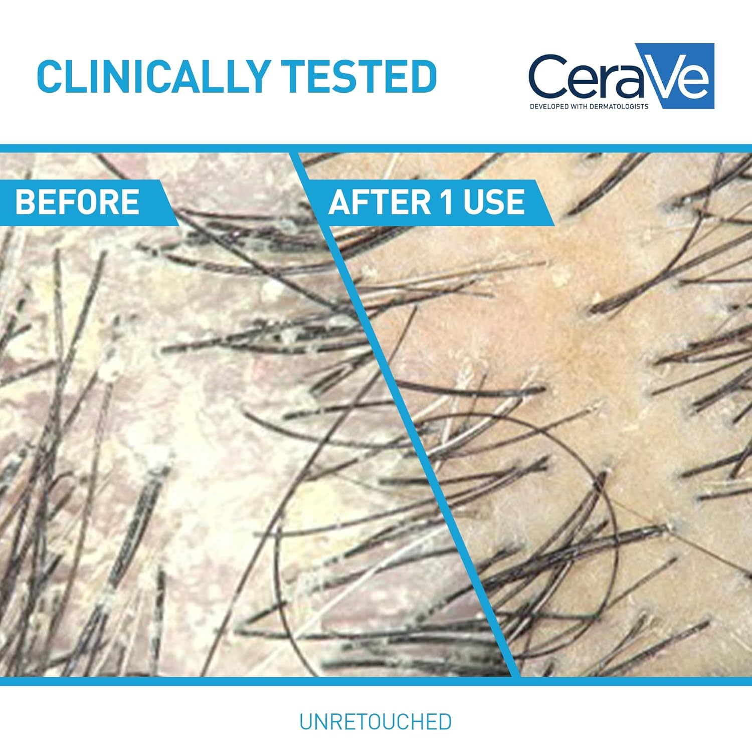 CeraVe Hydrating Anti Dandruff Shampoo 1% Pyrithione Zinc