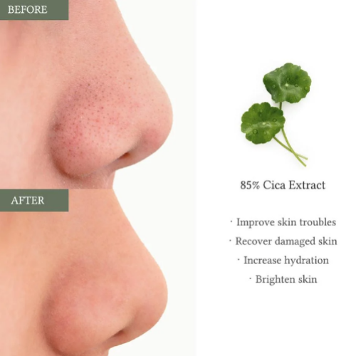Dr. Althea 2% Salicylic Acid Clear Pad
