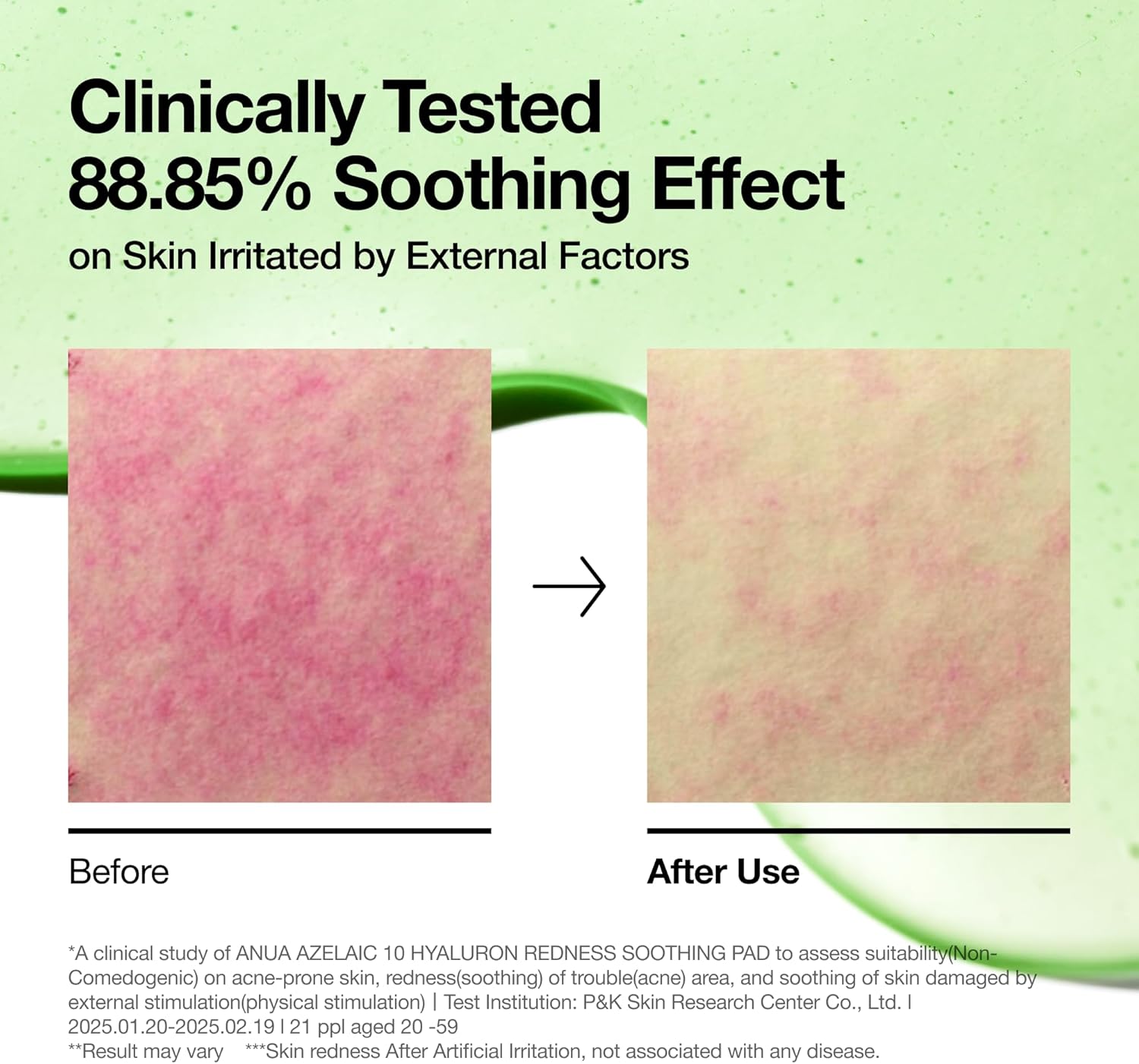 Anua Azelaic 10 Hyaluron Redness Soothing 90 Pad