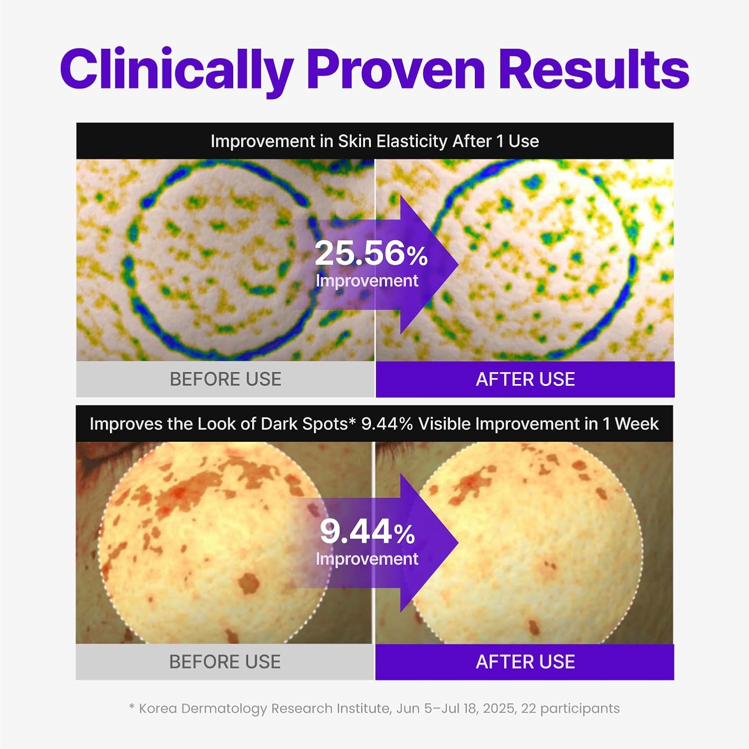 Centellian24 Expert Madeca Cream Active Renew PDRN 50ml